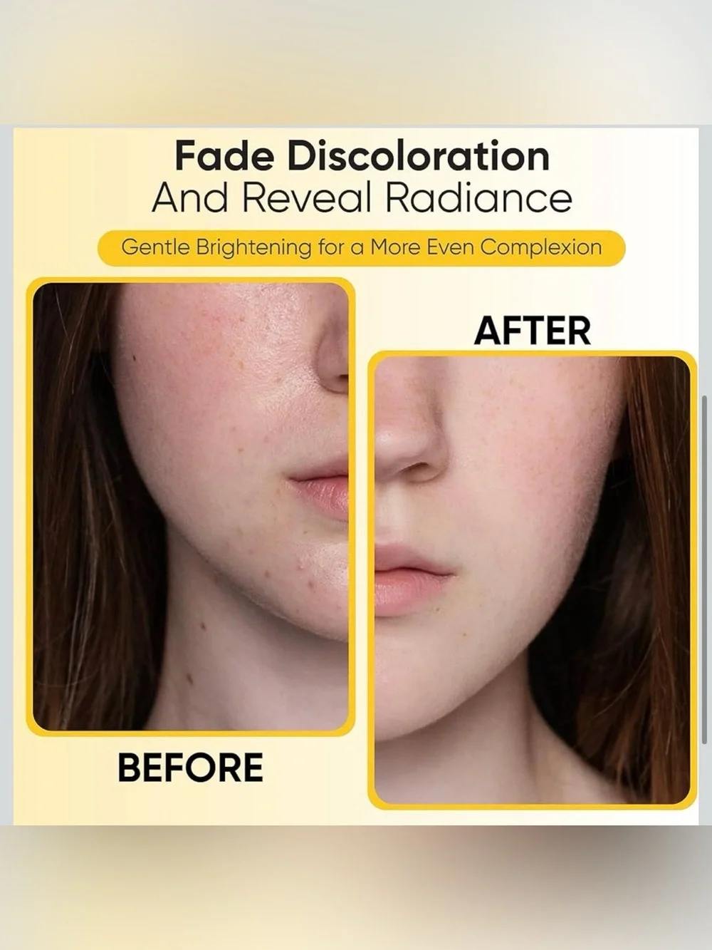 Raxaca Turmeric Kojic Acid Cleansing Pads - Yellow